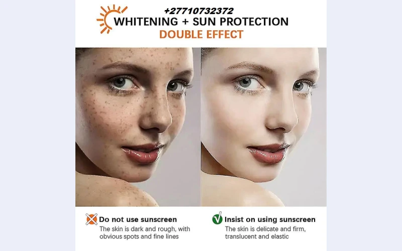 Permanent Skin Bleaching And Whitening Products In Barique Town in Grenada [+2/77/10/732/372] Scars And Stretch Marks Removal Cream In Rustenburg And Louis Trichardt South Africa