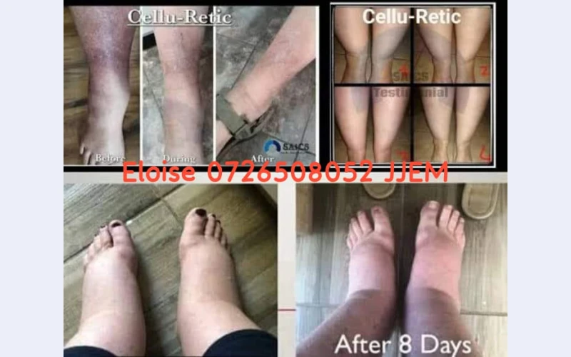 Legs products in vanderbijlpark. Helps in fiming up loose skin,known with treatment relief after sun burn and rejuvenating srcubs